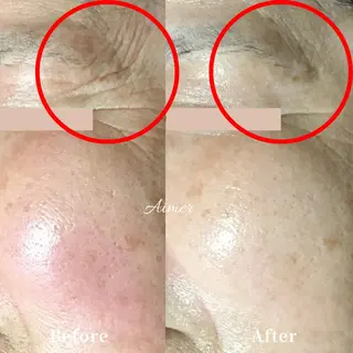 エステサロン Aimer(エメ)所属・エステサロン Aimer(エメ)のエステ・リラクイメージ