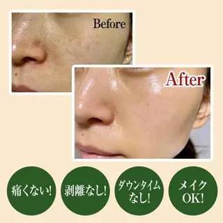 Nao店長 /ルヴォルテ大須のマツエク・マツパデザイン