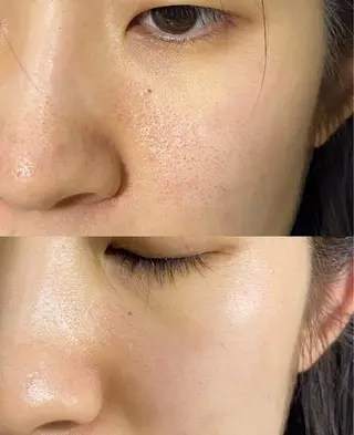 マツエク・マツパ 愛維美水光美肌専門店 メンズレディースokのエステ・リラクイメージ