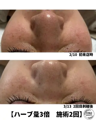 VIKI BEAUTY  クレイハーブピーリング・美肌脱毛専門店所属・VIKI BEAUTYのエステ・リラクイメージ