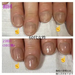 ネイル 自爪育成専門サロン エムロードゥ池下のネイルデザイン