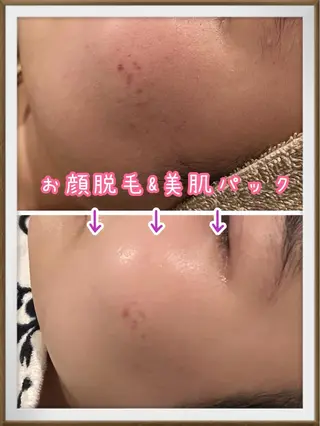 Dione八王子店所属・LUKE （ルーク）のエステ・リラクイメージ