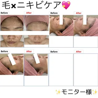 レイビス 渋谷店波間❤️のエステ・リラクイメージ