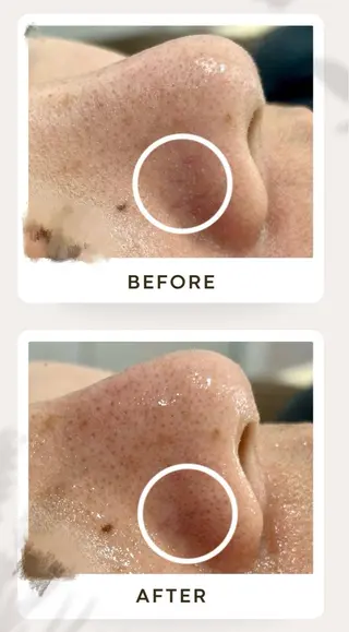 倉敷/玉島/20代 からの大人毛穴洗浄のエステ・リラクイメージ