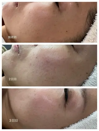 マツエク・マツパ SAYAKA 🫧のマツエク・マツパデザイン