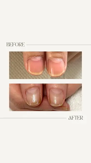 ネイル fote-自爪育成 ネイルケアサロン-のネイルデザイン