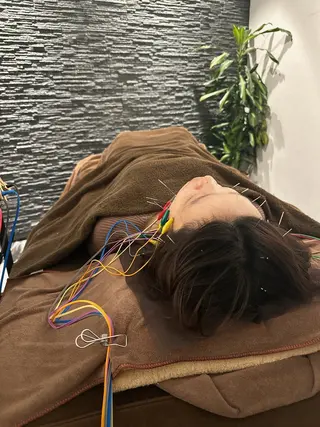 小顔矯/美容鍼/鍼灸 BeauJuのその他イメージ