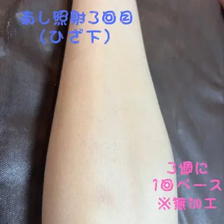 メンズ キッズ メンズ脱毛　FELISSE【フェリッセ】所属・メンズ脱毛フェリッセ /男女🆗キッズ🆗のエステ・リラクイメージ