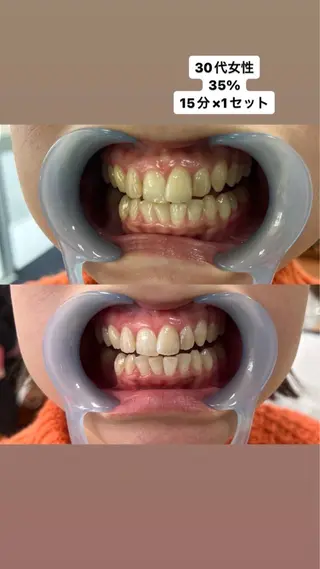 ララホワイトニング  大分駅前店所属・ララホワイトニング 大分駅前店のその他イメージ