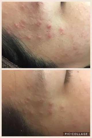 ミディアム カラー パーマ ヘアアレンジ メンズ キッズ ネイル マツエク・マツパ ニキビ・肌質改善専門 ♡人生が変わるサロンのエステ・リラクイメージ