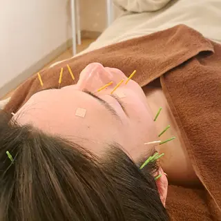 メンズ 美容鍼×エステ 鍼灸 サロンmiyabiのエステ・リラクイメージ