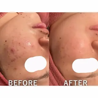 30minutes Rebeautyのエステ・リラクイメージ