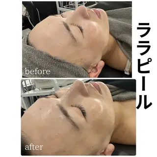 ULT ウルトのエステ・リラクイメージ