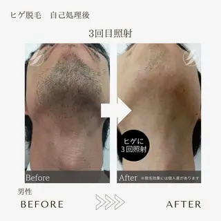 メンズ 本八幡salon83 ♡エイトミーのエステ・リラクイメージ