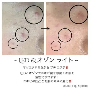 ビューティー ミロワールのエステ・リラクイメージ