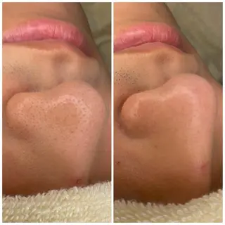 E LINDAのネイルデザイン