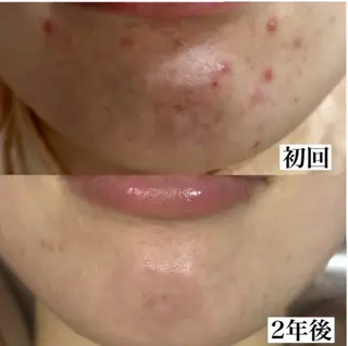 毛穴専門店 マカナアロハのエステ・リラクイメージ