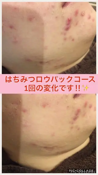 ミディアム カラー パーマ ヘアアレンジ メンズ キッズ ネイル マツエク・マツパ ニキビ・肌質改善専門 ♡人生が変わるサロンのエステ・リラクイメージ