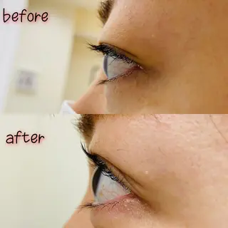 マツエク・マツパ 🌺アイリスト OSAKA🌺のマツエク・マツパデザイン