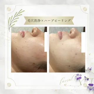 《 肌質×美肌 》 addissimoのエステ・リラクイメージ