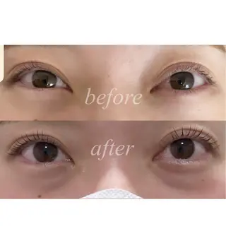 マツエク・マツパ 中村 陽香の眉毛・アイブロウイメージ