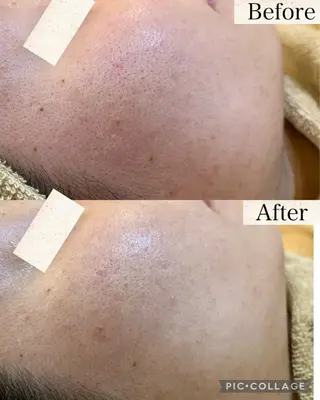 メンズ Beauty Salonheartのエステ・リラクイメージ