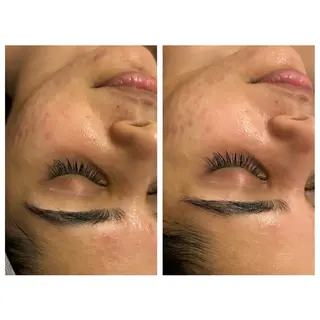 小顔コルギ ☆表参道/外苑前のエステ・リラクイメージ