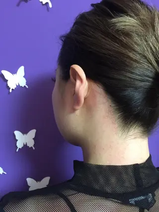 MIX脱毛 リュミエールアンジュのエステ・リラクイメージ