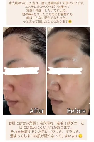 山城 春奈のエステ・リラクイメージ