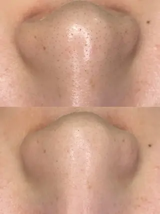 MA ORIの眉毛・アイブロウイメージ