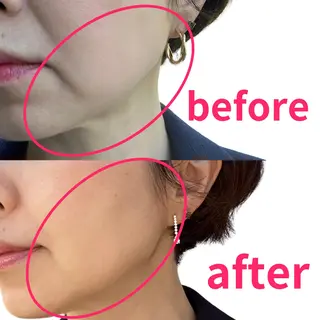 POLA 北花田店のエステ・リラクイメージ