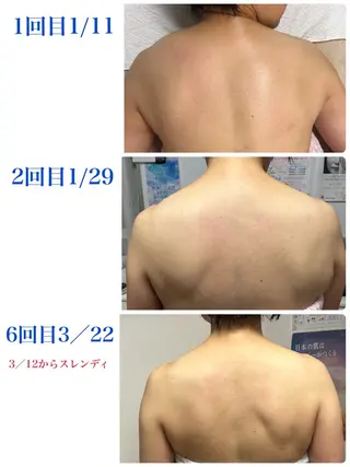 肌の質を変えるエステ 🤍🫧Nanaのエステ・リラクイメージ