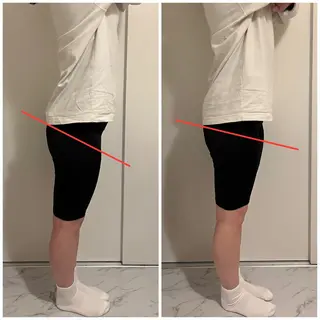 ✨ハリグリッター 山本由季✨のエステ・リラクイメージ