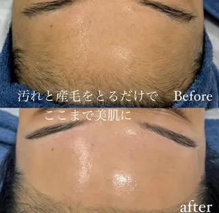 CHIO🌷心斎橋 毛穴・艶肌専門店のエステ・リラクイメージ