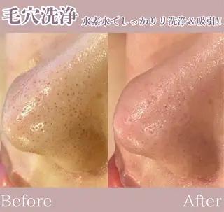 WAX・肌質改善・毛 穴洗浄/林愛真のエステ・リラクイメージ