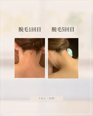 Chavi（チャヴィ）所属・脱毛サロンChavi 東府中店のエステ・リラクイメージ