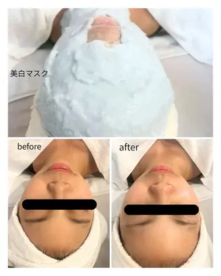 韓国/ピーリング 毛穴洗浄/POLAのエステ・リラクイメージ