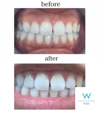 メンズ キッズ ホワイトニング ショップ町田店のその他イメージ