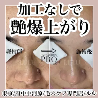 LULU ルルのエステ・リラクイメージ