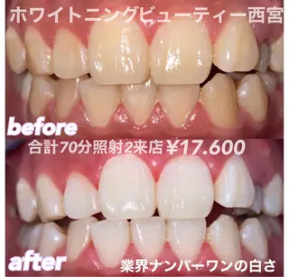 ホワイトニングビュー ティー西宮店のその他イメージ
