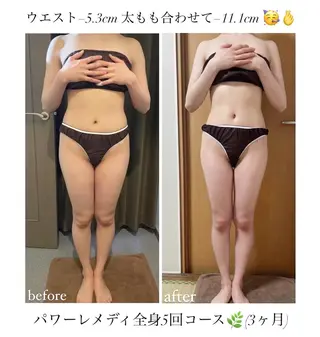 《本気痩せ×疲労改善 》  BILOOPのエステ・リラクイメージ