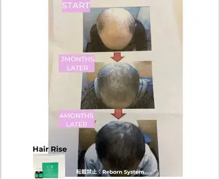 【福岡市西区 エステ】 GRANVIR(グランヴィール)所属・GRANVIR グランヴィールのエステ・リラクイメージ