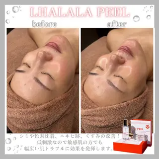 肌質改善サロン Meilily🦋のエステ・リラクイメージ