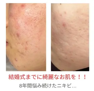 ベラージュ【美背中・ 美尻・フェイシャル】のエステ・リラクイメージ