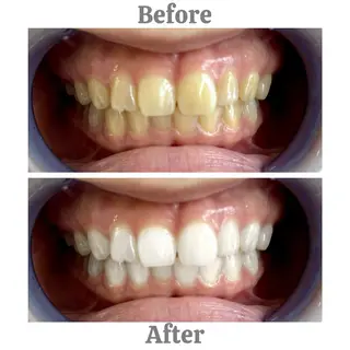 セルフホワイトニング エクシア相模大野店所属・mo moのその他イメージ