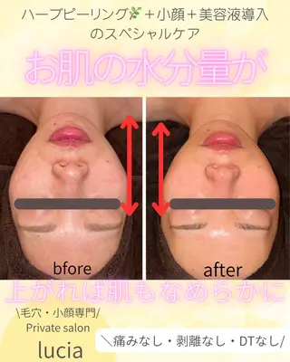 lucia  豊明 肌管理のエステ・リラクイメージ