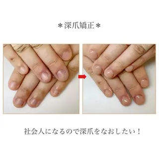 ネイル ネイルサロン アリュームのネイルデザイン
