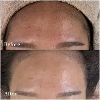 美肌育成専門サロンラクシュミー所属・毛穴肌管理サロン ラクシュミーのエステ・リラクイメージ