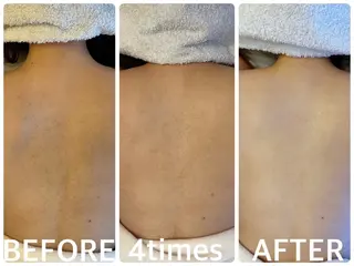 ハーブピーリング横浜 肌質改善専門店のその他イメージ