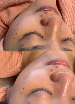 女性のお悩み美容 サロン　ヴィーナスのエステ・リラクイメージ